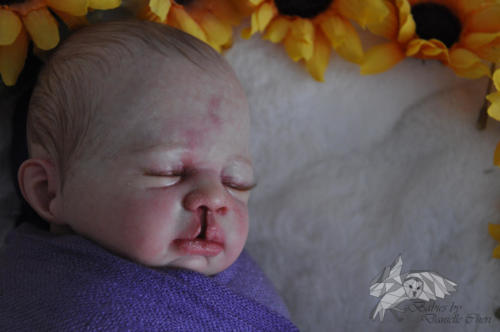 Special Needs and Mico Preemie